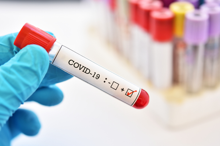 Blood sample tube positive with COVID-19