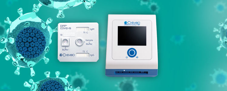 chembio test e1585773141745