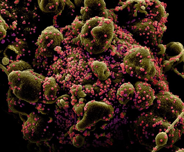 FILE PHOTO: Colorized scanning electron micrograph of an apoptotic cell heavily infected with SARS-COV-2 virus particles, also known as novel coronavirus Covid-19
