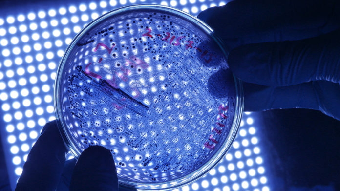Scientist microbiologist in protective gloves holding petri dish with dangerous bacteria over blue scientific light. legionnaires'