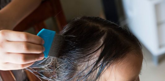 prevent lice