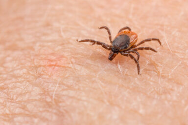 lyme disease tick