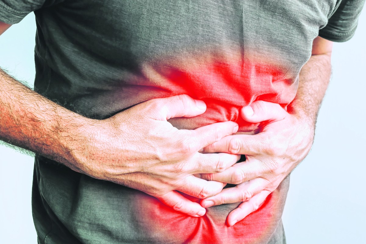 Acid Reflux