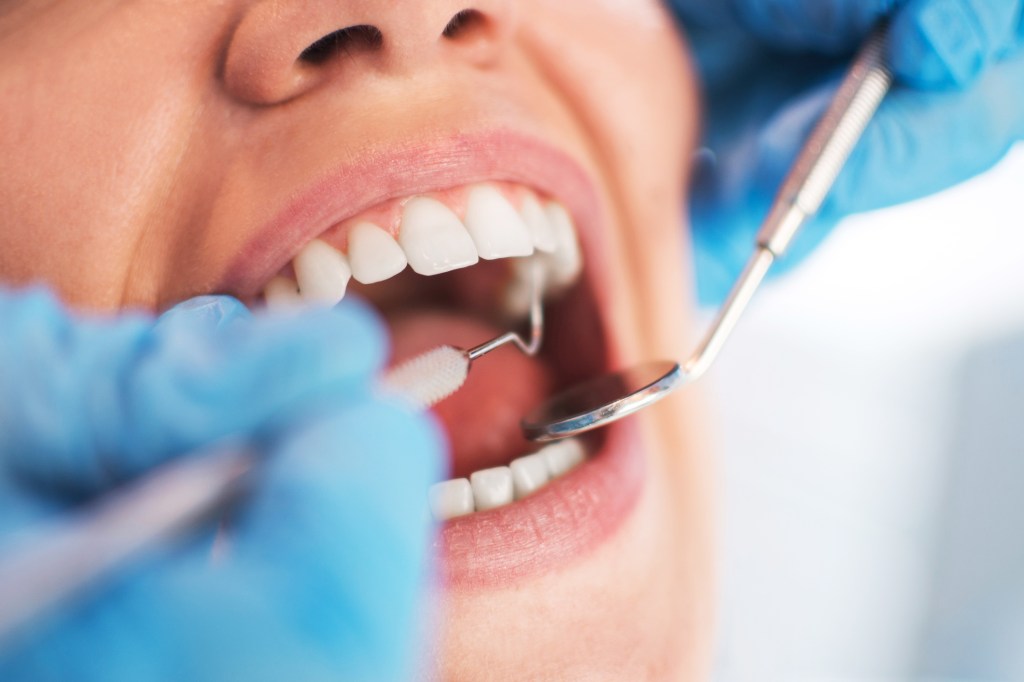 Why Brushing, Flossing and Dental Visits Matter so Much