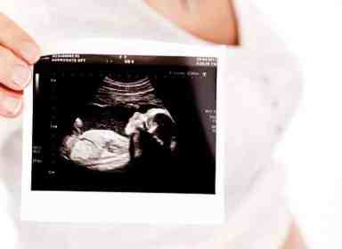 Stillbirth_A