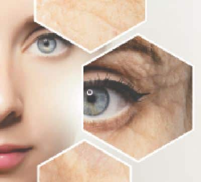 botox and injectables