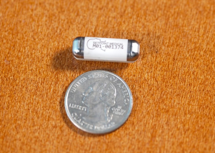 In SetPoint Medical’s RESET-RA clinical trial, conducted at Northwell Health, this vitamin-sized neuroimmune modulation device met the safety and effectiveness endpoints demonstrating potential clinical benefit for patients with rheumatoid arthritis.