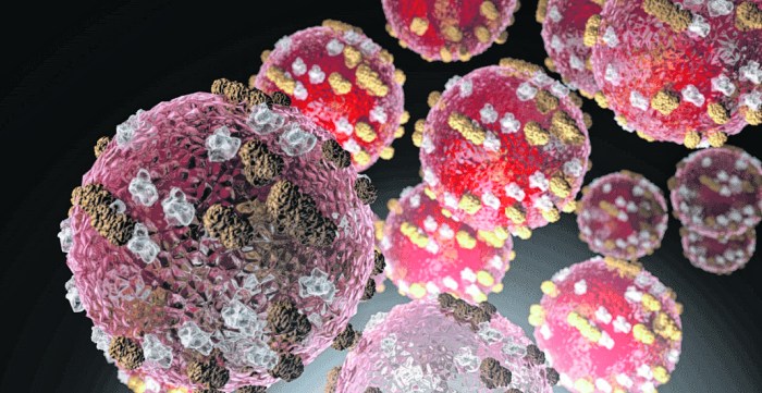 Measles