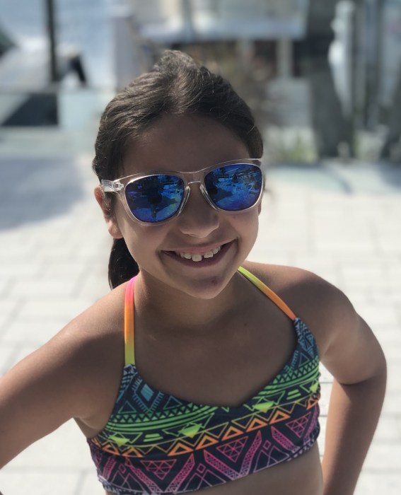 Mermelstein cracked her tooth when she was in fourth grade.