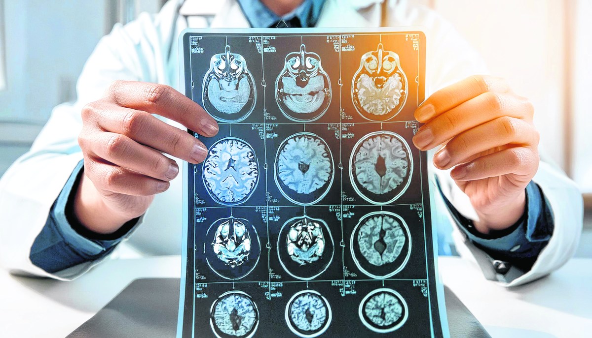Multiple sclerosis (MS) used to be considered untreatable. Today, breakthroughs in medicine let patients live happy, healthy lives. Here's what the experts say.